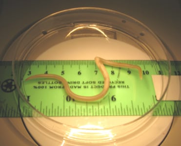 A_lumbricoides_adult_OrangeCounty.jpg Figure B: Adult female <em>A. lumbricoides</em>. Image courtesy of the Orange County Public Health Laboratory, Santa Ana, CA.