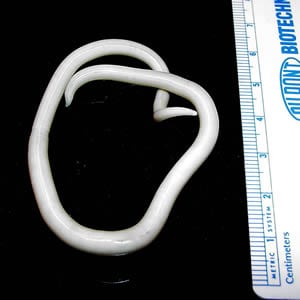 Ascaris_female.jpg Figure A: Adult female <em>A. lumbricoides</em>.