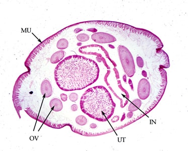Ascaris_female_cross_section.jpg Figure E: Cross-section of an adult female <em>A. lumbricoides</em>, stained with hematoxylin and eosin (H&E). Note the presence of the prominent muscle cells (MU), gravid uterus (UT), intestine (IN) and coiled ovary (OV).