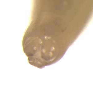 Ascaris_mouthparts_OrangeCounty.jpg Figure C: Close-up of the anterior end of an adult <em>A. lumbricoides</em>. Note the three 'lips.' Image courtesy of the Orange County Public Health Laboratory, Santa Ana, CA.
