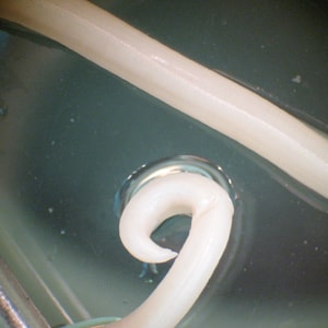 Ascaris_posterior_BAM.jpg Figure D: Posterior end of a male <em>A. lumbricoides</em>, showing the curled tail.