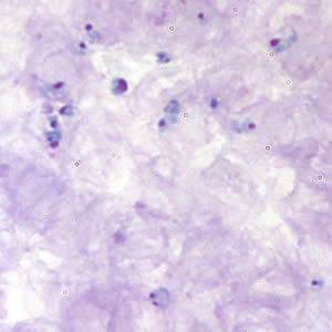 Figure A: <em>Babesia</em> sp. in thick blood smears stained with Giemsa.