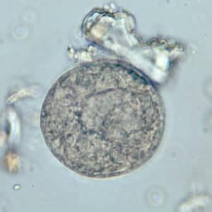 Bcoli_cyst_wtmt3.jpg Figure A: <em>B. coli</em> cyst in a wet mount, unstained.