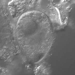 Bcoli_troph_DIC.jpg Figure C: <em>B. coli</em> trophozoite under differential interference contract (DIC) microscopy, 500× magnification