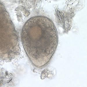 Bcoli_troph_wtmt.jpg Figure B: <em>B. coli</em> trophozoite in a wet mount, 500× magnification. Note the visible cilia on the cell surface.