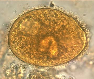 Bcoli_troph_wtmt2_OR.jpg Figure D: <em>B. coli</em> trophozoite in a wet mount, 1000× magnification. Note the visible cilia on the cell surface. Image contributed by the Oregon Public Health Laboratory.