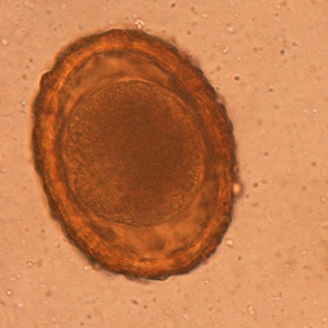 BaylisEgg_WKU1.jpg Figure A: Unembryonated egg of <em>B. procyonis</em>