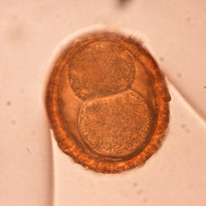 BaylisEgg_WKU2.jpg Figure B: Egg of <em>B. procyonis</em>. In this specimen, the developing embryo has started to divide.