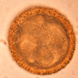 BaylisEgg_WKU3.jpg Figure C: Eggs of <em>B. procyonis</em> in a further state of cleavage.