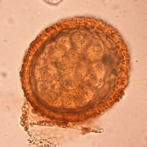 BaylisEgg_WKU4.jpg Figure D: Eggs of <em>B. procyonis</em> in a further state of cleavage.