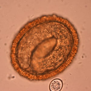 BaylisEgg_WKU5.jpg Figure E: Embryonated eggs of<em> B. procyonis</em>, showing the developing larva inside.
