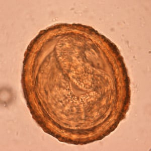BaylisEgg_WKU6.jpg Figure F: Embryonated eggs of <em>B. procyonis</em>, showing the developing larva inside.