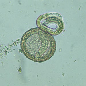 Baylisascaris_larva_hatching_CA1.jpg Figure A: Larva of <em>B. procyonis</em> hatching from an egg.