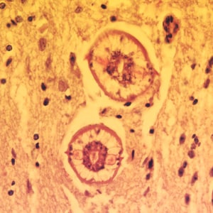 Baylisascaris_brain_400x_BAM1.jpg Figure A: Cross-sections of larvae of <em>B. columnaris</em> in the brain of a laboratory-infected mouse. The larval morphology and microscopic manifestations are essentially identical to <em>B. procyonis</em>. Image taken at 400x magnification.