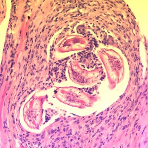 Baylisascaris_muscle_200x_BAM1.jpg Figure C: Cross-sections of larvae of <em>B. columnaris</em> in muscle of a laboratory-infected mouse. The larval morphology and microscopic manifestations would be similar with <em>B. procyonis</em> in human tissue. Image taken at 400x magnification.