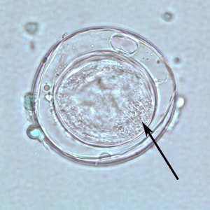 Bertiella_egg_BAM_1000x2.jpg Figure C: An egg of <em>Bertiella</em> sp. liberated from a gravid proglottid. The arrows point to the hooklets.
