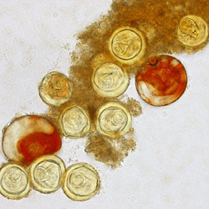 Bertiella_egg_Clinipath_A.jpg Figure A: Eggs of <em>Bertiella</em> sp. liberated from proglottids. The proglottids were shed from a human patient who had lived for a number of years in Africa. In several of these eggs, the pyriform apparatus can be easily seen. Images courtesy of Clinipath Pathology, Perth, Australia.