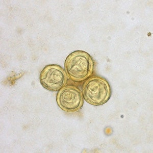 Bertiella_egg_Clinipath_B.jpg Figure B: Eggs of <em>Bertiella</em> sp. liberated from proglottids. The proglottids were shed from a human patient who had lived for a number of years in Africa. In several of these eggs, the pyriform apparatus can be easily seen. Images courtesy of Clinipath Pathology, Perth, Australia.
