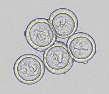 Bertiella_eggs_LTU1.jpg Figure E: Eggs of <em>Bertiella</em> sp. liberated from gravid proglottids. Image courtesy of the National Public Health Surveillance Laboratory, Vilnius, Lithuania.