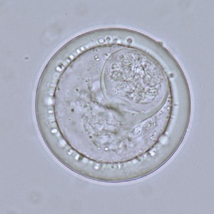 Bertiella_eggs_LTU2.jpg Figure F: Eggs of <em>Bertiella</em> sp. liberated from gravid proglottids. Image courtesy of the National Public Health Surveillance Laboratory, Vilnius, Lithuania.