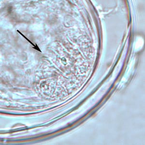 Bertiella_hooks_BAM_1000x2.jpg Figure D: An egg of <em>Bertiella</em> sp. liberated from a gravid proglottid. The arrows point to the hooklets.