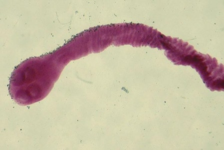 Bstuderiscolex_Bradbury.jpg Figure A: Scolex of <em>Bertiella</em> studeri. Image courtesy of Richard Bradbury.