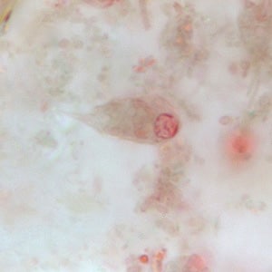 C_mesnili_troph_BM1.jpg Figure A: Trophozoite of <em>C. mesnili</em> from a stool specimen, stained with trichrome. Image taken at 1000x magnification.