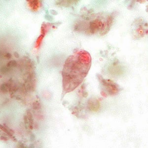 C_mesnili_troph_BM2.jpg Figure B: Trophozoite of <em>C. mesnili</em> from a stool specimen, stained with trichrome. Image taken at 1000x magnification.