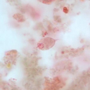 C_mesnili_troph_BM3.jpg Figure C: Trophozoite of <em>C. mesnili</em> from a stool specimen, stained with trichrome. Image taken at 1000x magnification.
