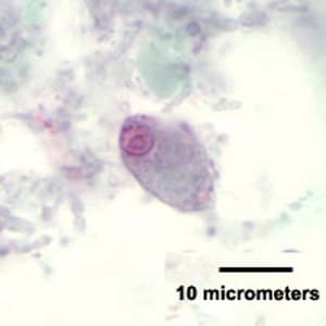 C_mesnili_troph_HB1.jpg Figure D: Trophozoite of <em>C. mesnili</em> from a stool specimen, stained with trichrome. Image taken at 1000x magnification.