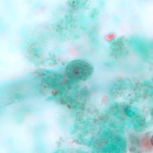 C_mesnili_cyst_trichrome_BM1.jpg Figure A: Cyst of <em>C. mesnili</em> in a stool specimen, stained with trichrome. Image taken at 1000x magnification.