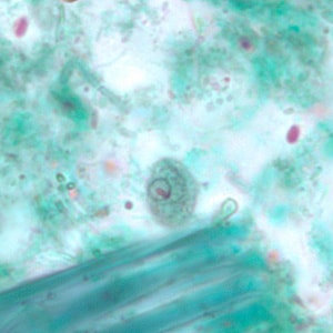 C_mesnili_cyst_trichrome_BM2.jpg Figure B: Cyst of <em>C. mesnili</em> in a stool specimen, stained with trichrome. Image taken at 1000x magnification.
