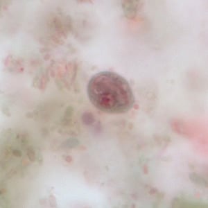 C_mesnili_cyst_trichrome_BM3.jpg Figure C: Cyst of <em>C. mesnili</em> in a stool specimen, stained with trichrome. Image taken at 1000x magnification.