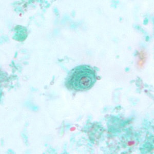 C_mesnili_cyst_trichrome_BM4.jpg Figure D: Cyst of <em>C. mesnili</em> in a stool specimen, stained with trichrome. Image taken at 1000x magnification.