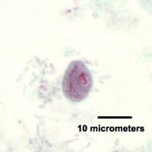 C_mesnili_cyst_trichrome_HB1.jpg Figure E: Cyst of <em>C. mesnili</em> in a stool specimen, stained with trichrome. Image taken at 1000x magnification.