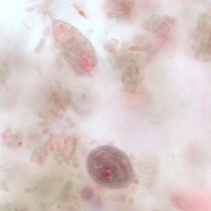 C_mesnili_cyst_troph_BM1.jpg Figure F: Cyst (lower) and trophozoite (upper) of <em>C. mesnili</em> in a stool specimen, stained with trichrome. Image taken at 1000x magnification.