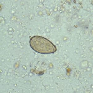 Clonorchis_egg.jpg Figure A: <em>C. sinensis</em> egg: the small knob at the abopercular end is visible in this image.
