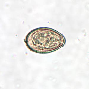 Clonorchis_egg2.jpg Figure B: <em>C. sinensis</em> egg. Note the operculum resting on