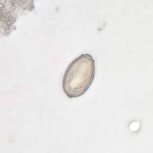 Clonorchis_egg5_web.jpg Figure C: <em>C. sinensis</em> egg; image taken at 400× magnification.