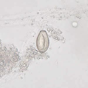 Clonorchis_egg6_web.jpg Figure D: <em>C. sinensis</em> egg; image taken at 400× magnification.