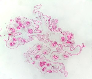 tissue_coen_A Figure A: Coenurus removed from a subcutaneous nodule on the leg of a patient, stained with hematoxylin and eosin (H&E). Image taken at ~30x magnification.