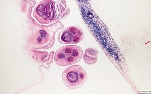 eye_B Figure B: Closer view of the protoscolices from the coenurus shown in Figure A.