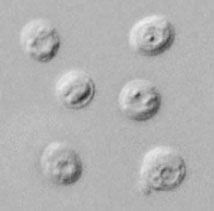 DPDxCrypto_oo_DIC.jpg Figure B: <em>Cryptosporidium parvum</em> oocysts in wet mount, under differential interference contrast (DIC) microscopy. The oocysts are rounded and measure 4.2 µm - 5.4 µm in diameter. Sporozoites are visible inside the oocysts, indicating that sporulation has occurred.