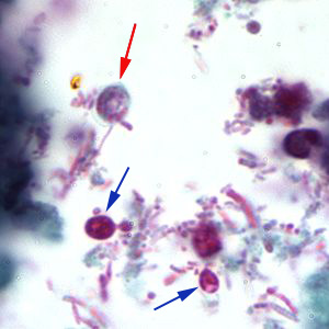 Cparvum_trichrome2_BAM.jpg Figure B: <em>Cryptosporidium</em> sp. oocyst stained with trichrome. Oocysts may be detected, but should not be confirmed by this method. Trichrome staining is inadequate for a definite diagnosis because oocysts will appear unstained. Here the <em>Cryptosporidium</em> oocyst is represented by a red arrow; the blue arrows represent yeast.