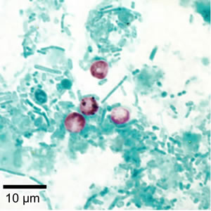 Crypto_acidfast3_web.jpg Figure B: <em>Cryptosporidium parvum</em> oocysts stained with modified acid-fast. Against a blue-green background, the oocysts stand out in a bright red stain.
