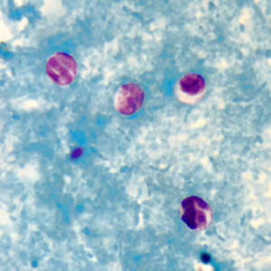 Crypto_acidfast_web.jpg Figure C: <em>Cryptosporidium</em> sp. oocysts stained with modified acid-fast.
