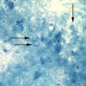 Crypto_acidfast2_100x_annot.jpg Figure B: Unstained <em>Cryptosporidium</em> sp. oocysts (black arrows) on a slide stained with modified acid-fast. The slide was counterstained with malachite green.