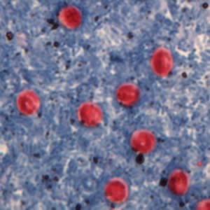 Crypto_modified-ZN.jpg Figure A: <em>Cryptosporidium</em> sp. oocysts stained with Ziehl-Neelson modified acid-fast. Image contributed by the Oregon State Public Health Laboratory.