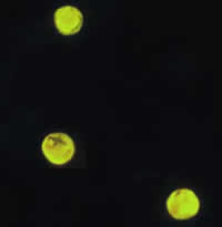 DPDxCrypto_oo_Aura.jpg Figure A: <em>Cryptosporidium parvum</em> oocysts stained with the fluorescent stain auramine-rhodamine.