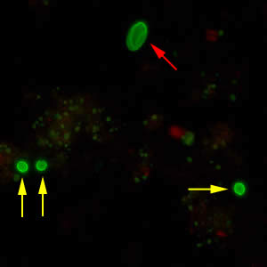 CryptoGiardiaDFA_400x1_arrows.jpg Figure C: <em>Cryptosporidium</em> sp. oocysts (yellow arrows) and cysts of Giardia duodenalis (red arrow) labeled with immunofluorescent antibodies.